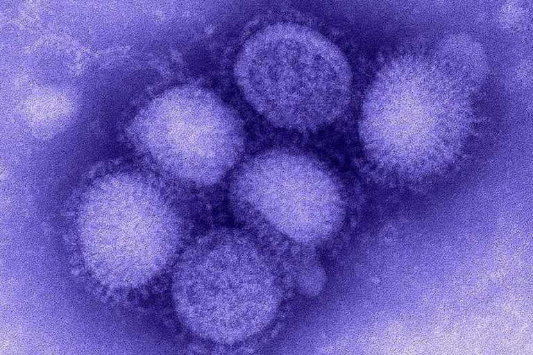 Alertă medicală! Un bărbat, prima victimă a gripei porcine, la Hunedoara