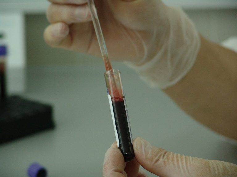 Noii detalii despre pneumonia misterioasă din China. Ce au descoperit cercetătorii
