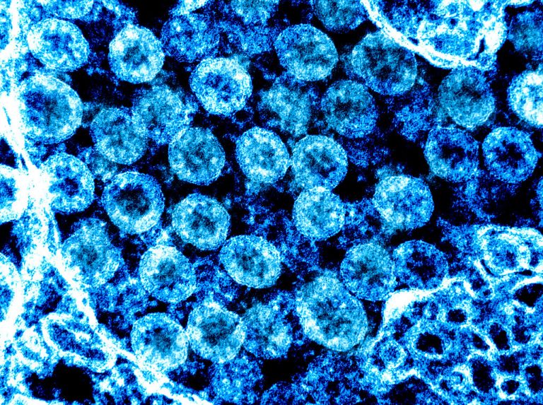 Bilanțul epidemiei de coronavirus la nivel mondial