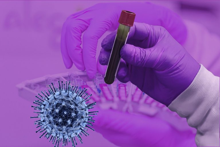 Circa 80 de vaccinuri anti coronavirus, în lucru în laboratoarele din toată lumea, aproape jumătate dintre ele în SUA