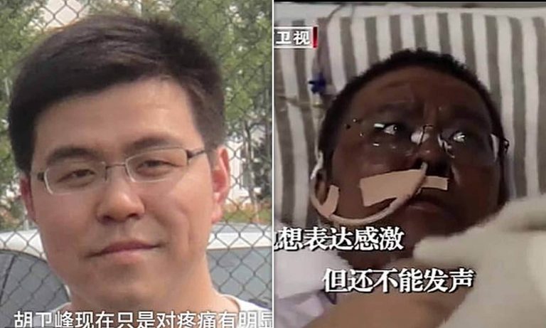 Unul dintre medicii chinezi a căror piele s-a închis la culoare a murit, după patru luni la terapie intensivă