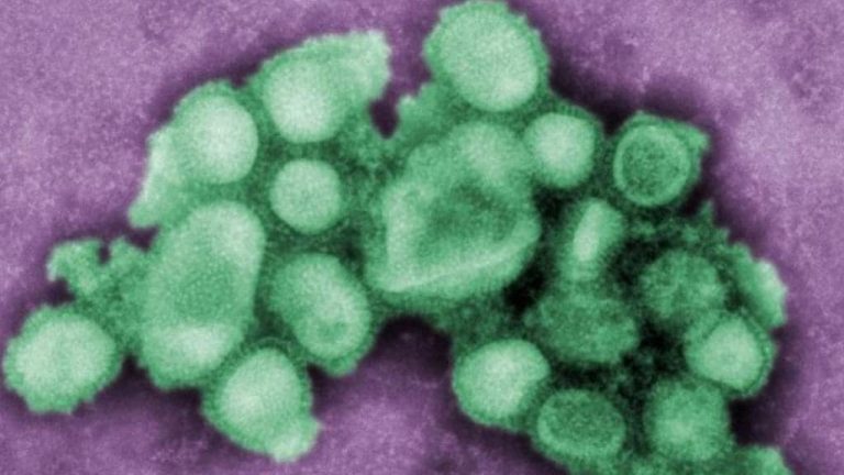 Fauci, detaliu îngrijorător: Noul virus gripal cu potențial pandemic descoperit în China are atât trăsături ale gripei porcine din 2009, cât și ale gripei spaniole