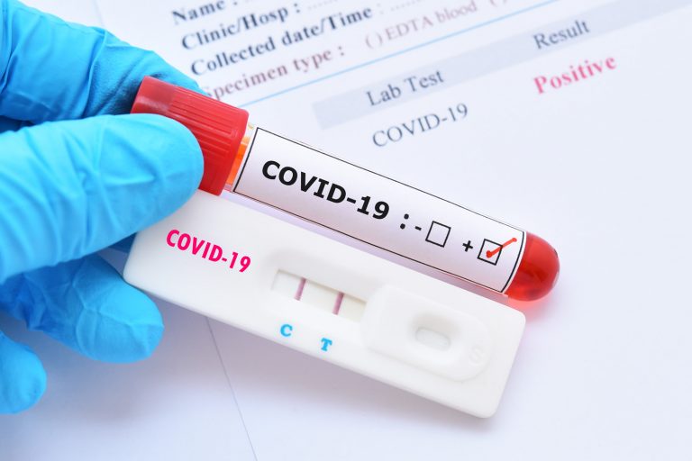 Coronavirus cases remain high in Romania, 48 deaths in last day
