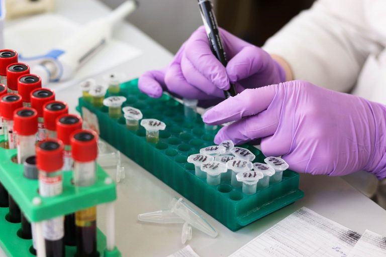 Un test de sânge ar putea detecta boala Parkinson înainte de apariţia simptomelor