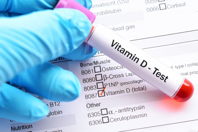 vitaminD