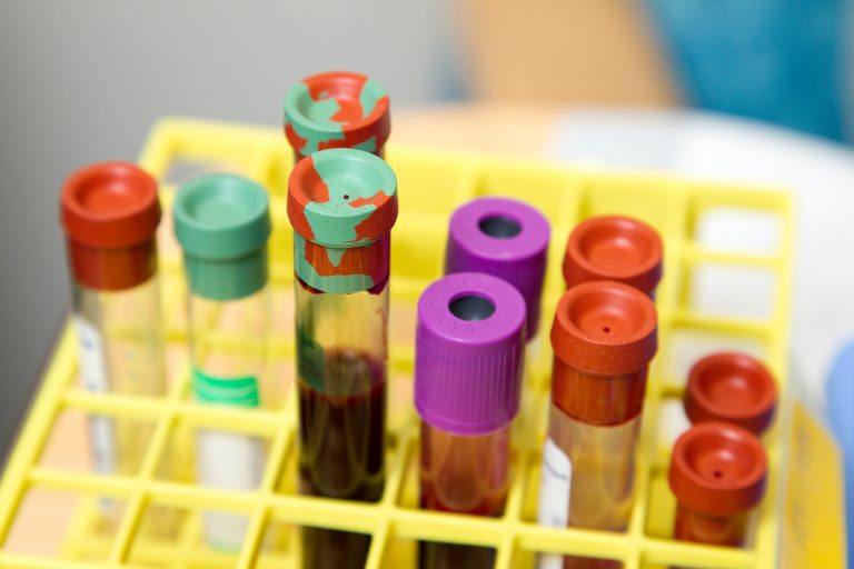 Numărul persoanelor sub 50 de ani diagnosticate cu cancer, în creştere la nivel mondial – studiu