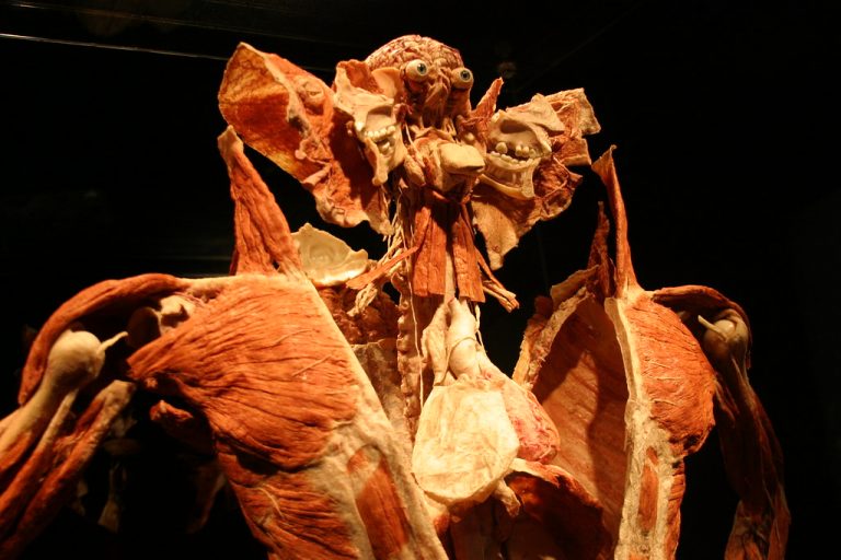 Anchetatorii ruși iau în vizor expoziţia de cadavre umane „Body Worlds”