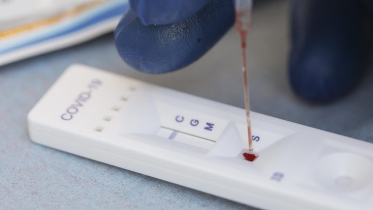 Te-ai vaccinat și vrei să afli dacă ai anticorpi? Iată cât costă un test