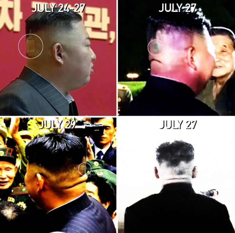 Plasturele misterios de pe ceafa lui Kim Jong Un, un nou semn de întrebare legat de sănătatea dictatorului nord-coreean