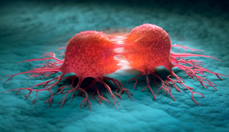 Nivelul ridicat de colesterol alimentează tumorile, conferind rezistenţă celulelor canceroase, arată un studiu