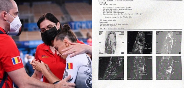 Gymnast Larisa Iordache has osteoarthritis, her club says, after she pulled out of balance beam Olympic final