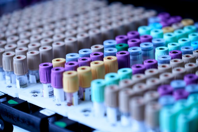 Marea Britanie demarează studiul clinic al unui test de sânge care poate detecta 50 de tipuri de cancer