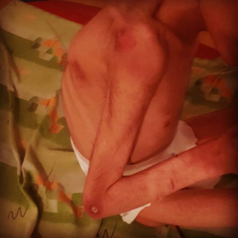 Copii şi tineri, hrăniţi cu dropsuri şi mâncare stricată, într-un centru pentru persoane cu dizabilităţi severe din Călăraşi