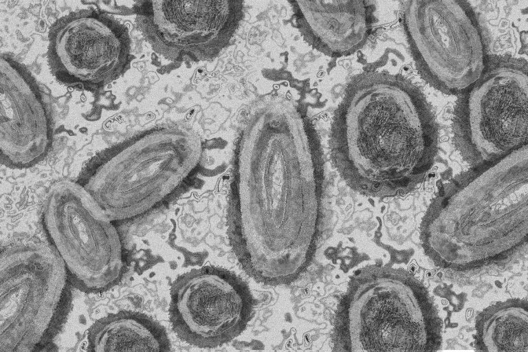 Doi cercetători, puşi sub acuzare de justiţia americană pentru că au încercat să introducă în SUA virusul mpox inactivat adus din Africa