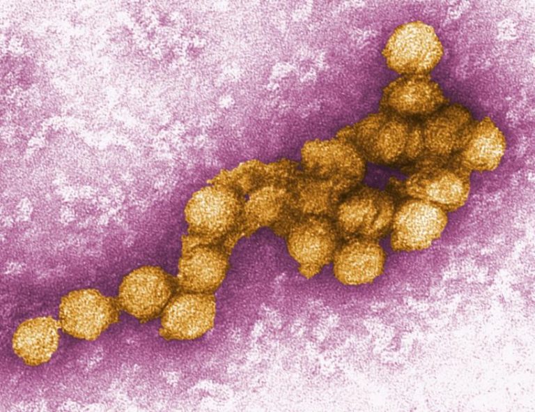 Un virus periculos se răspândește în România, anunță INSP