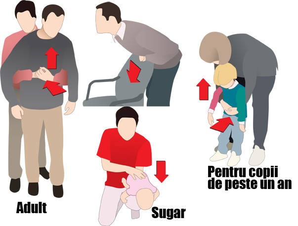 Dr. Ciuhodaru: Lipsa educaţiei pentru sănătate e frecvent letală / Manevra Heimlich trebuie învăţată şi exersată în şcoli