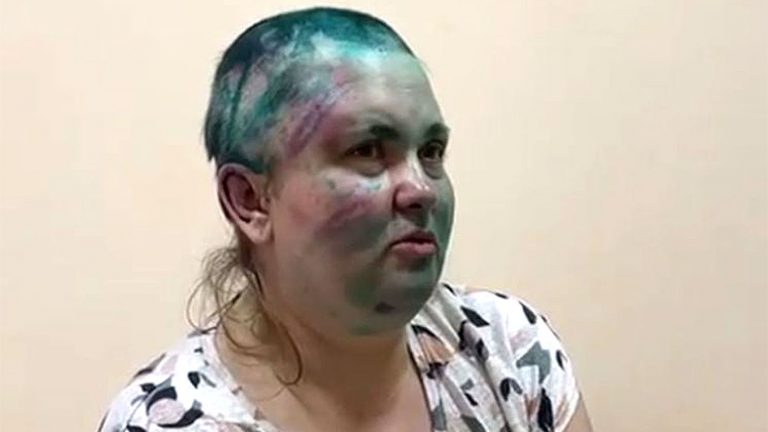 Jurnalista de investigaţie de la Novaia Gazeta, bătută crunt în Cecenia, transferată la Moscova