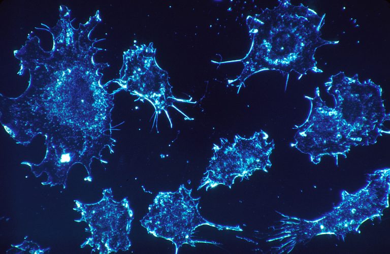 Can’t we do something about Romania’s above-average cancer mortality rate?