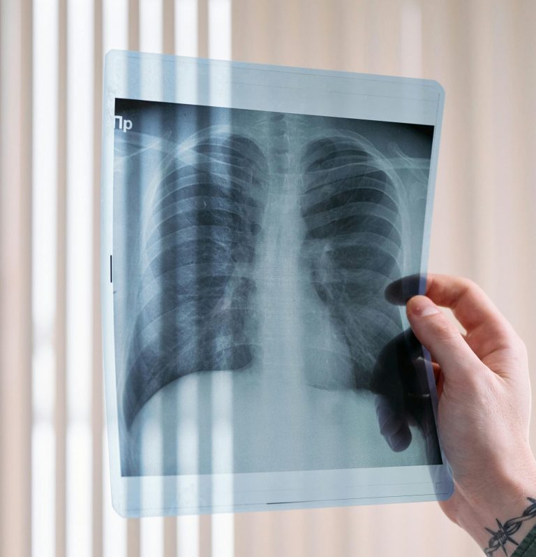 O imunoterapie ţintită pentru tratamentul cancerului pulmonar, autorizată în SUA