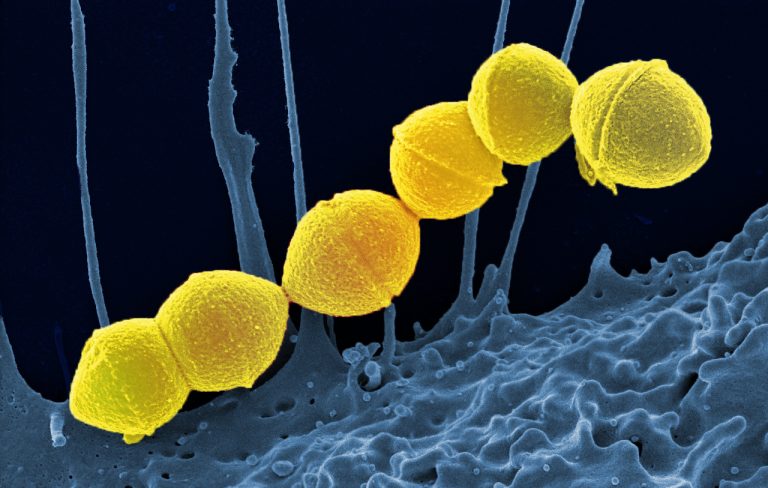 Cazurile de infectare cu o bacterie ”mâncătoare de carne”, la un nivel record în Japonia
