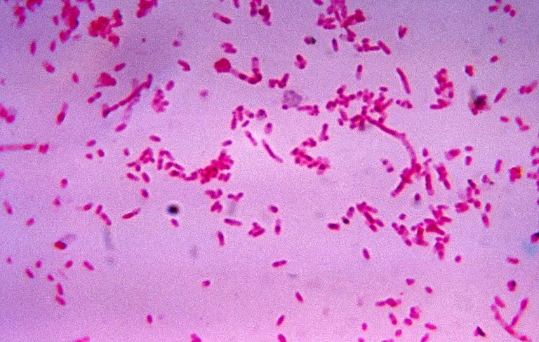Studiu | Cancerul de cap şi de gât ar putea fi ”topit” de o bacterie asociată de obicei cu cancerul intestinal