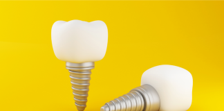 implant dentar candoptampentruunimplantdentar_.png