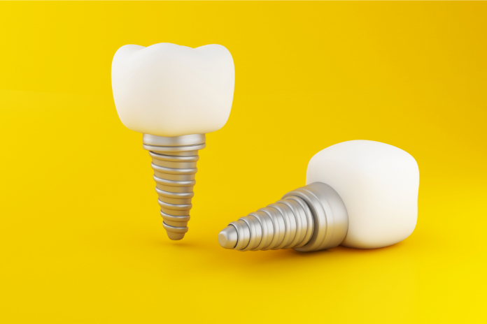 implant dentar candoptampentruunimplantdentar_.png
