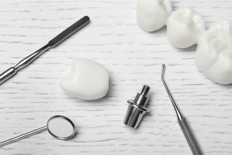 Implanturi dentare și tratamentele ortodontice – când sunt recomandate?