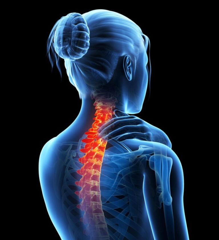 Prof. dr. Cătălina Poiană: Osteoporoza reprezintă o problemă de sănătate publică. Este cea mai frecventă boală metabolică osoasă