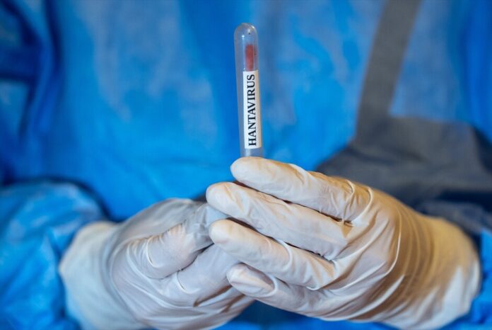 Romania confirms hantavirus case, unrelated to cruise ship outbreak