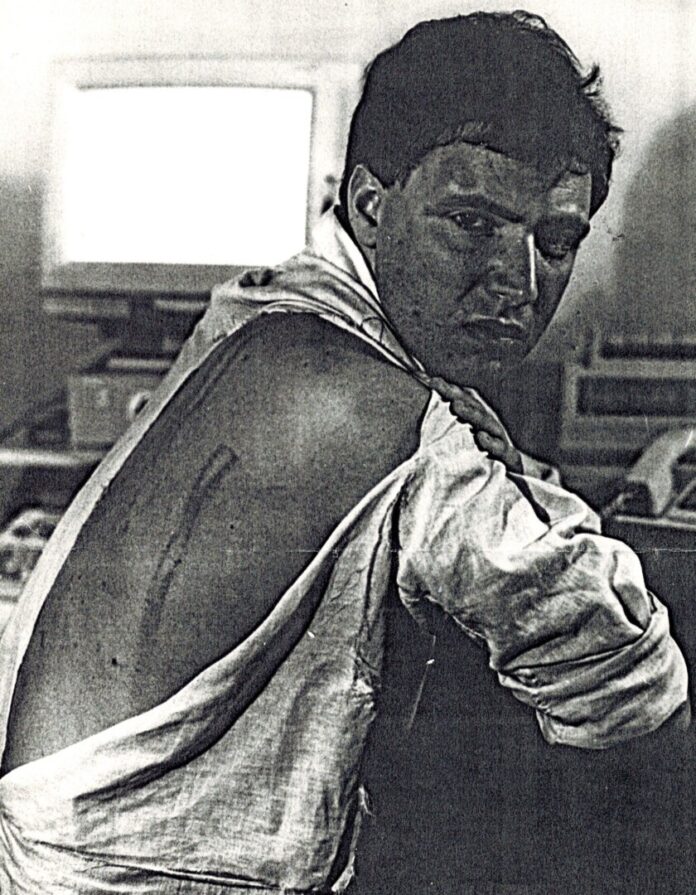 PHOTO-2026-06-24-17-53-57 Dan Perry after he was beaten by Romanian police during a miners' rampage in Bucharest in June 1990.